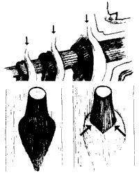 A better diagram of branch growth.